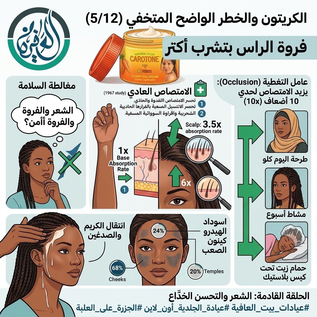 الجزرة على العلبة (5/12): فروة الراس بتشرب أكتر