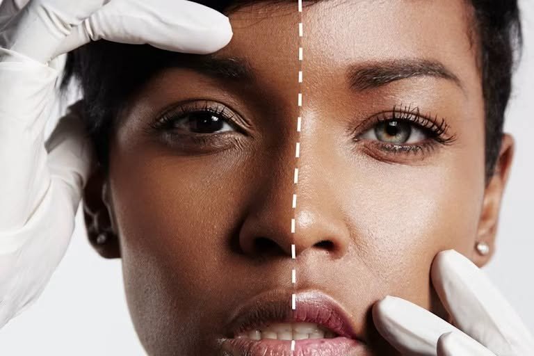المرحلة الخامسة: المراهقة - بين المرآة والمجتمع - وباء التبييض: السم في الدسم (Skin-lightening creams misuse) (٣/٥) - الجزء الأول: المشكلة