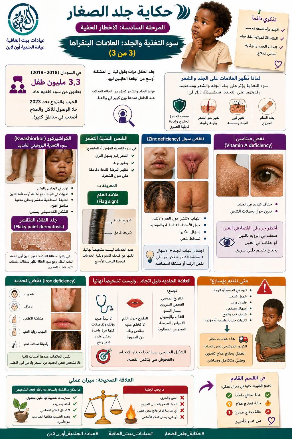 المرحلة السادسة: الأخطار الخفية - سوء التغذية والجلد: العلامات البنقراها (٣ من ٣)