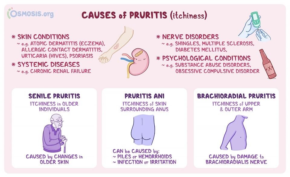 🎯 الحكة بدون طفح جلدي (Pruritus) ودلالاتها الصحية