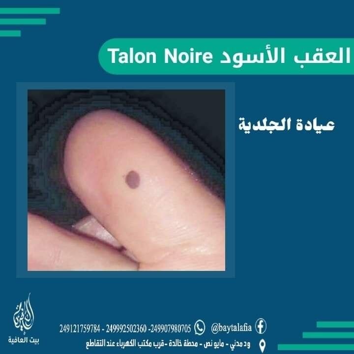 العقب الأسود Talon Noire