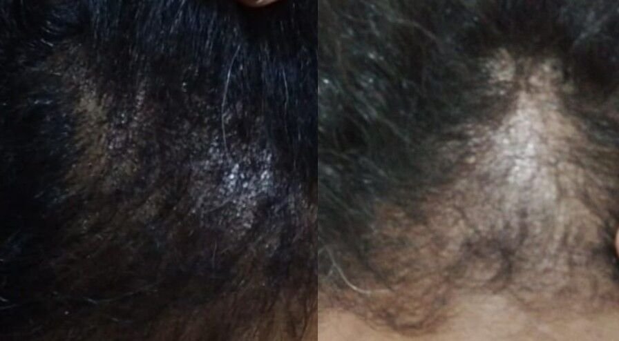 علاج مشاكل الشعر يحتاج مقاربة شاملة! 💇‍♀️✨
