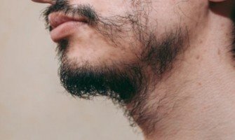 فراغات اللحية وطرق إنباتها أو تكثيفها
