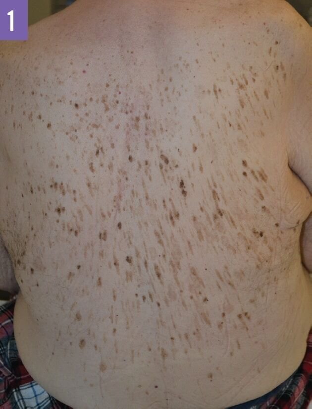 حين تصبح الشكوى التجميلية الطابع ذات دلالة أخطر