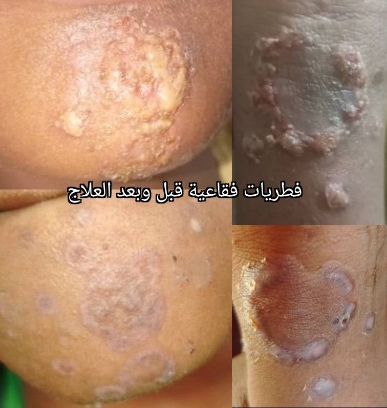 انتبهوا للمظاهر غير المعتادة للأمراض الشائعة