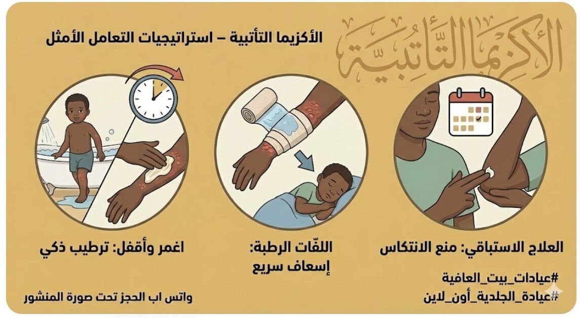 الاكزيما التأتبية – استراتيجيات التعامل الأمثل