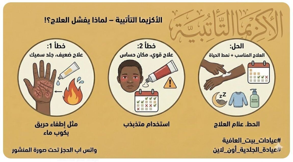 الاكزيما التأتبية – ليه بفشل العلاج؟!