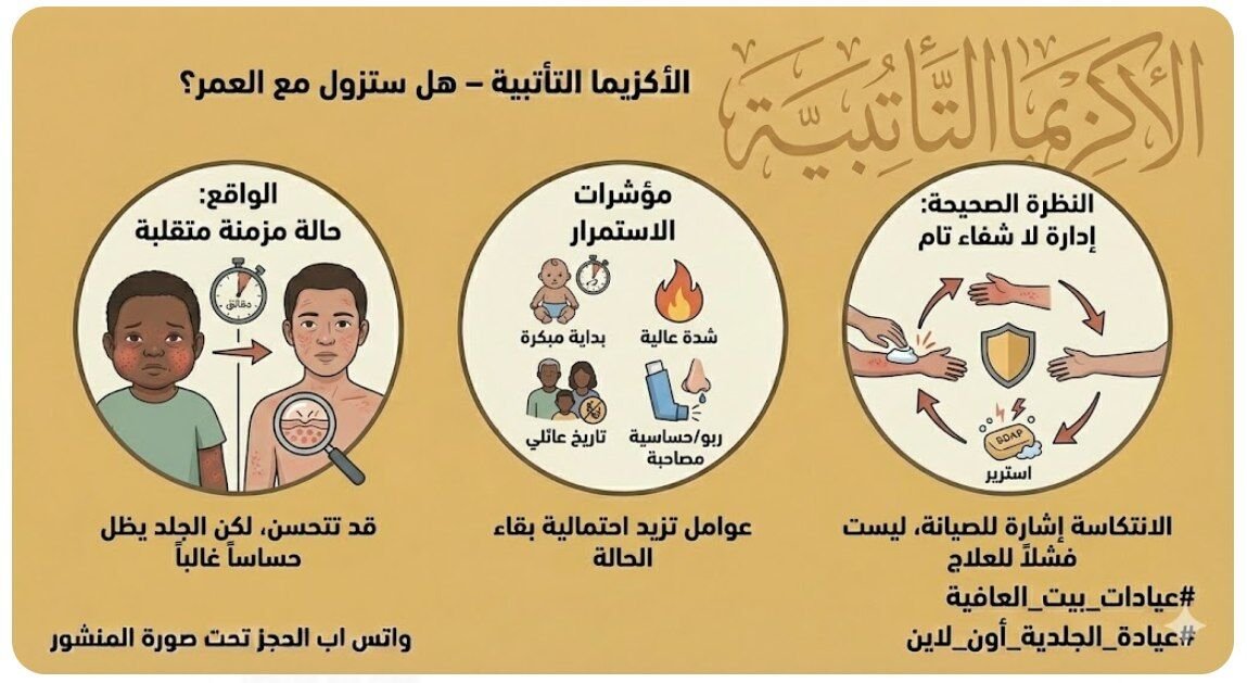 الاكزيما التأتبية – هل حتروح مع العمر؟