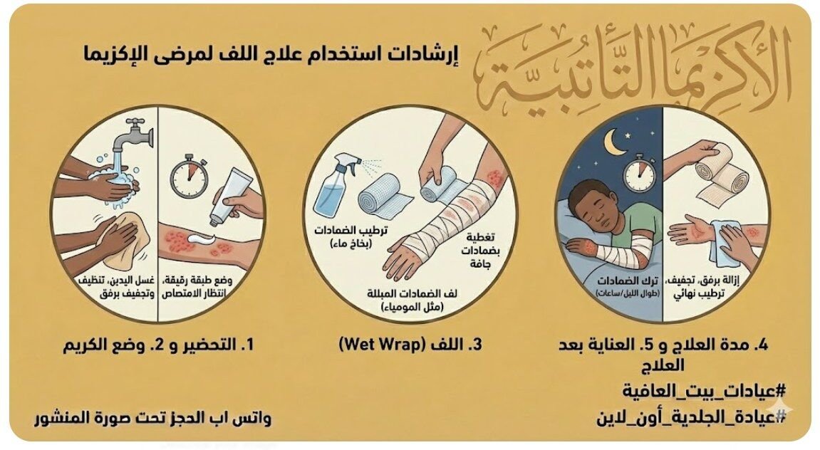 الاكزيما التأتبية – تقنيات الحماية: علاج اللف الرطب