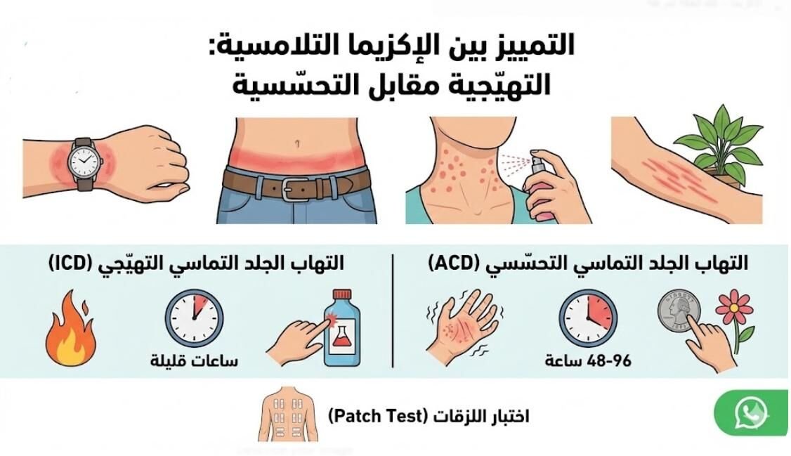 الإكزيما التلامسية – كيفية التمييز