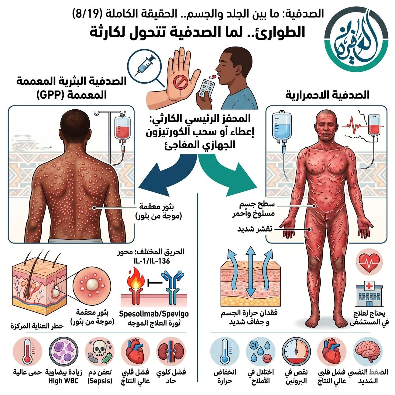 الطوارئ.. لما الصدفية تتحول لكارثة