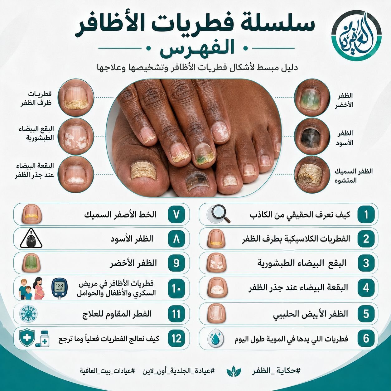 سلسلة فطريات الأظافر — الفهرس