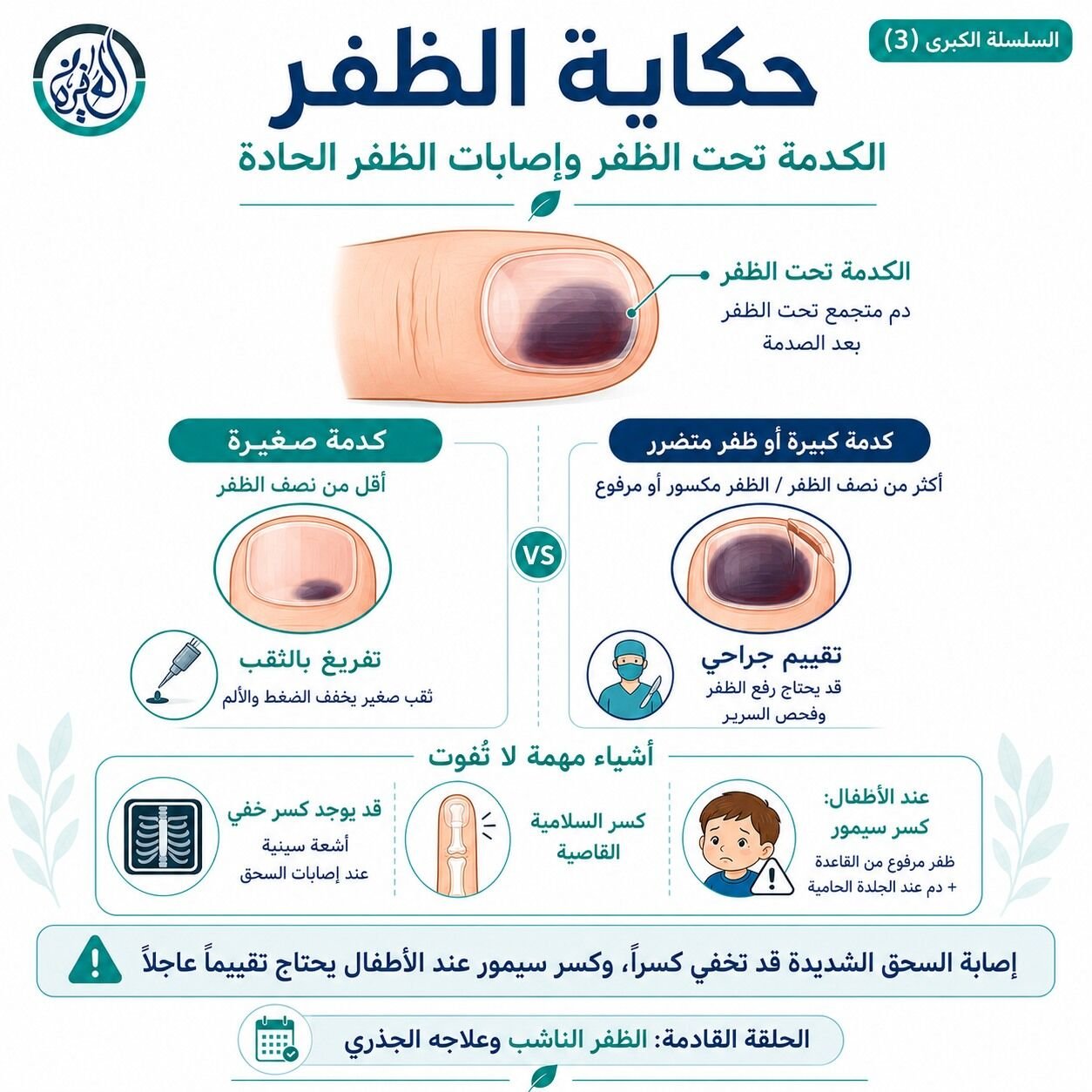 الكدمة تحت الظفر وإصابات الظفر الحادة