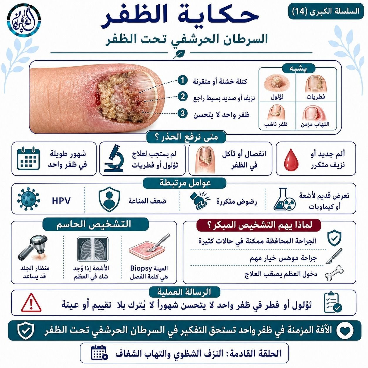 السرطان الحرشفي تحت الظفر