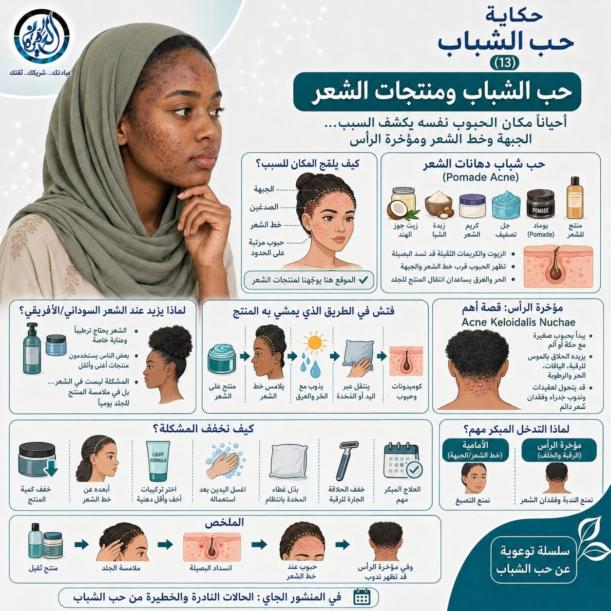حب الشباب ومنتجات الشعر
