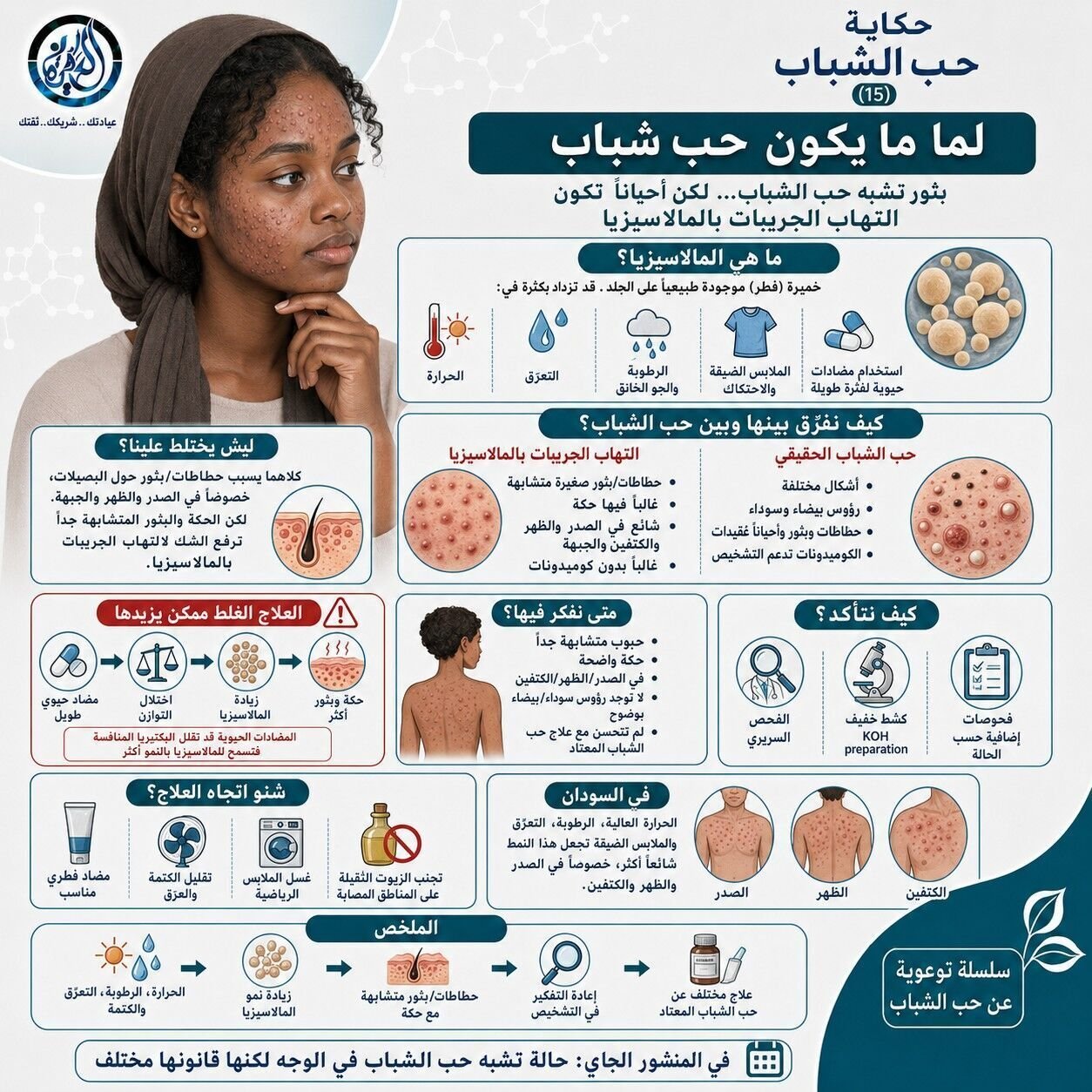 لما ما يكون حب شباب