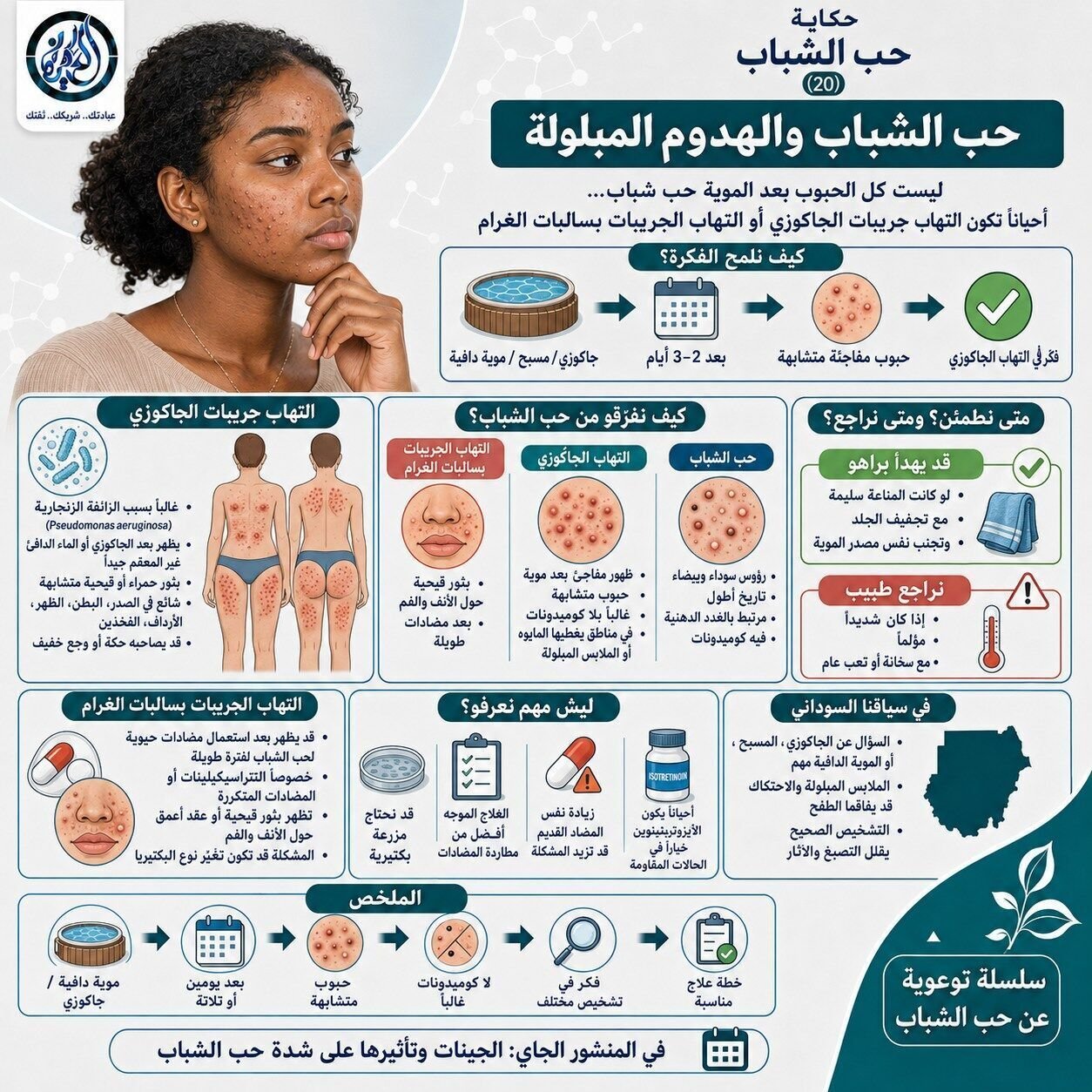 حب الشباب والهدوم المبلولة