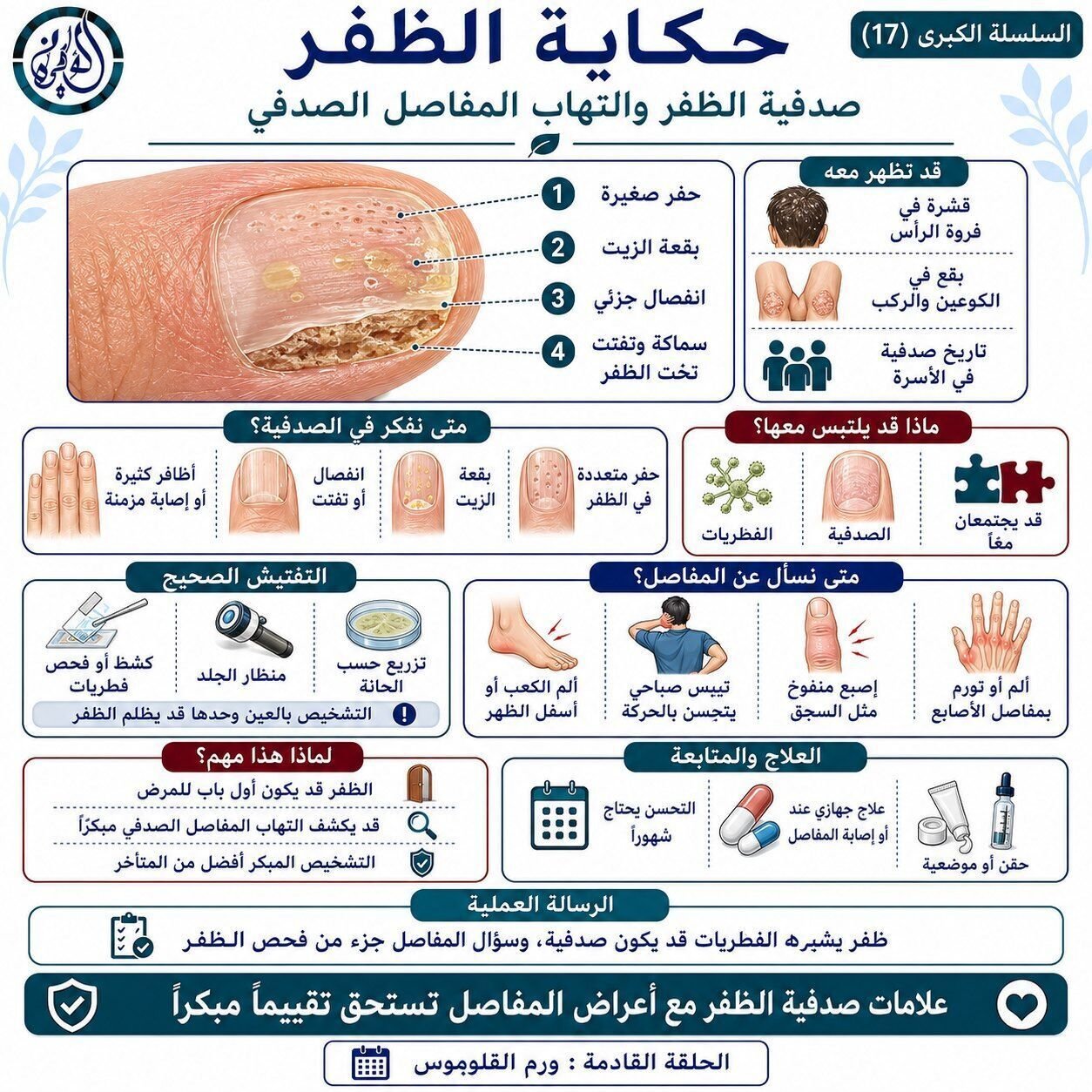 صدفية الظفر والتهاب المفاصل الصدفي