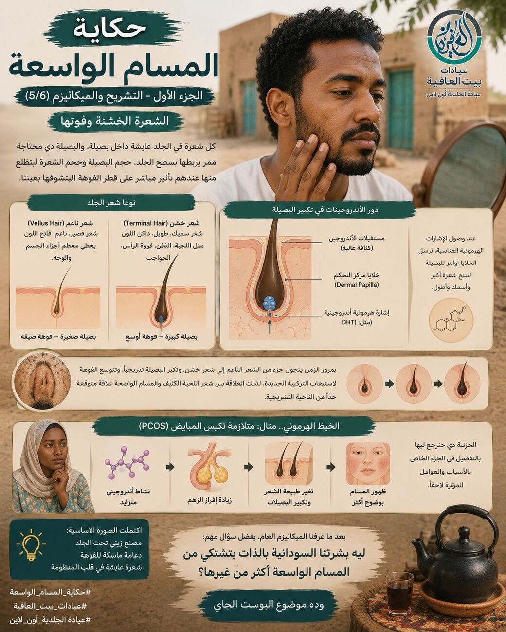 الشعرة الخشنة وفوهتها
