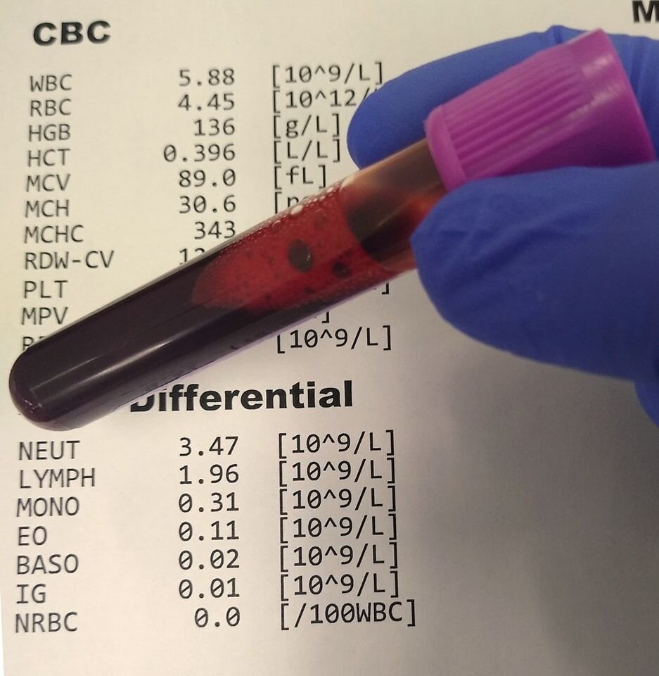 ⚕️ فهم تعداد الدم الكامل (CBC) Complete Blood Count⚕️