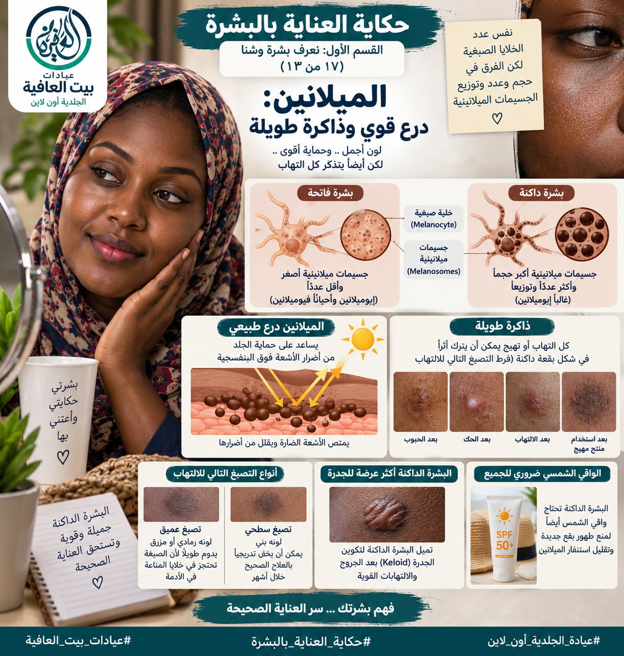 القسم الأول: نعرف بشرة وشنا (٧ من ١٣) - الميلانين: درع قوي وذاكرة طويلة