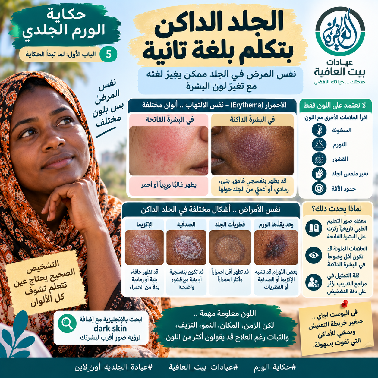 الجلد الداكن بتكلم بلغة تانية