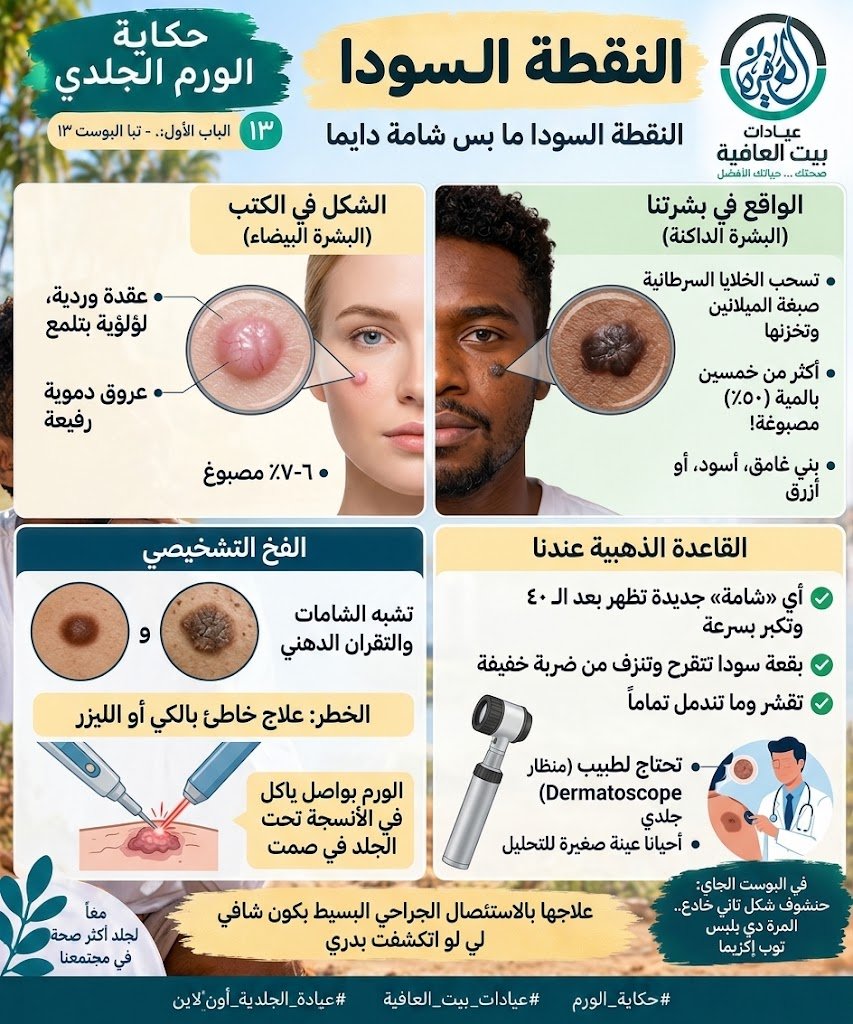 النقطة السودا ما بس شامة دايما