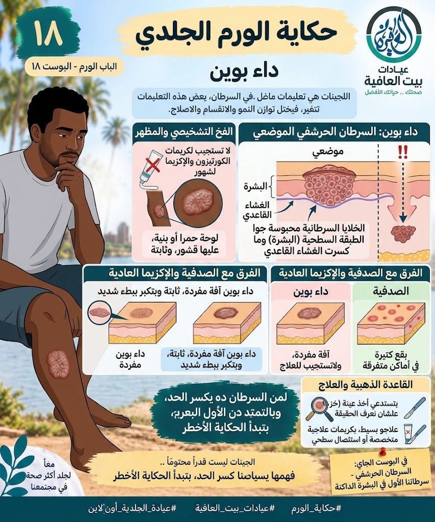 داء بوين