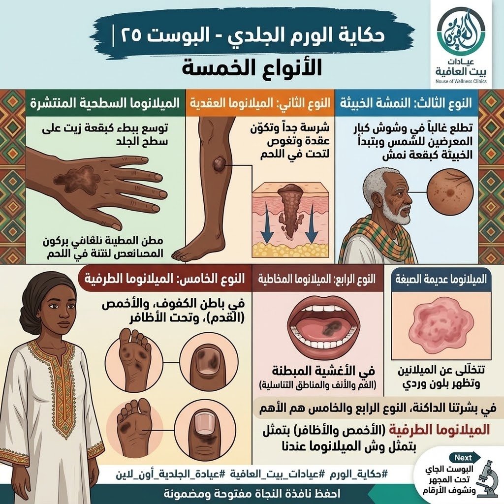 الأنواع الخمسة