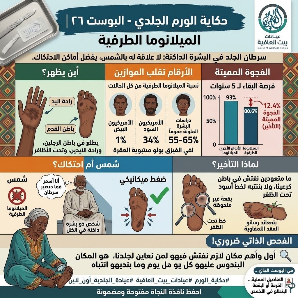 الميلانوما الطرفية