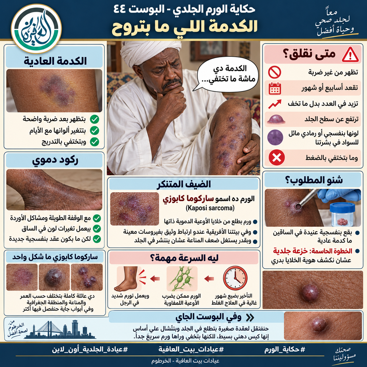 الكدمة اللي ما بتروح