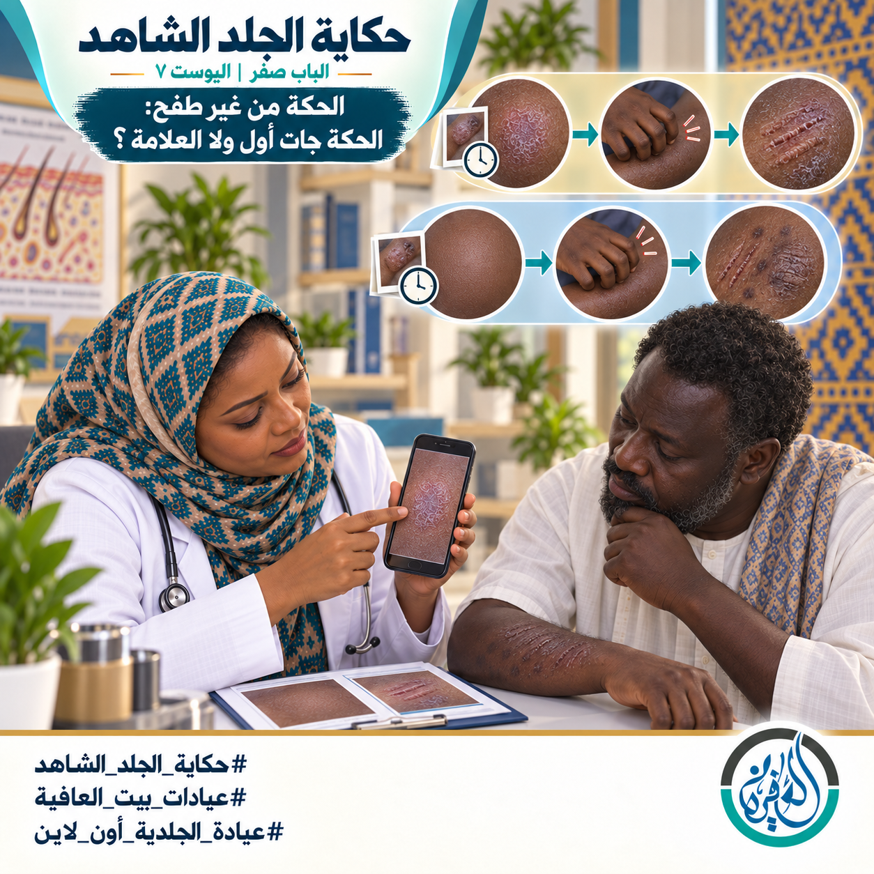 الباب صفر: الحكة من غير طفح: الحكة جات أول ولا العلامة؟