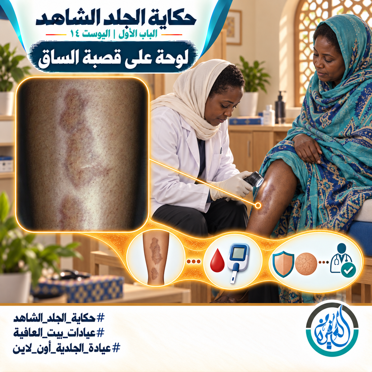 الباب الأول: لوحة على قصبة الساق