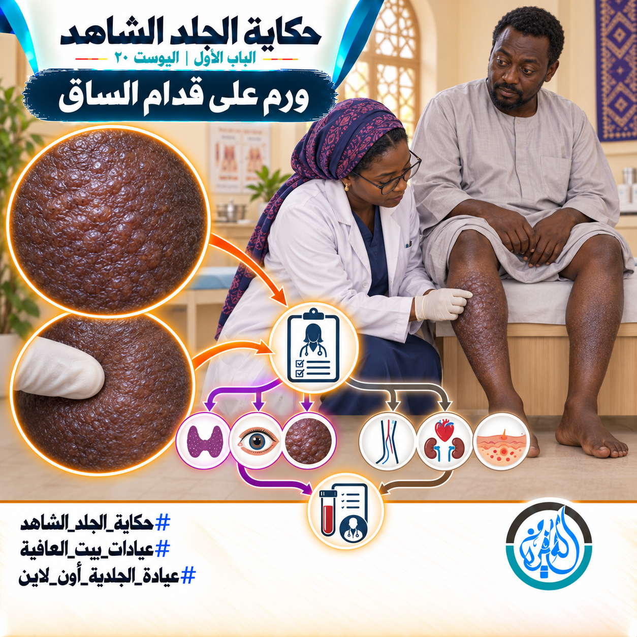 الباب الأول: ورم على الساق