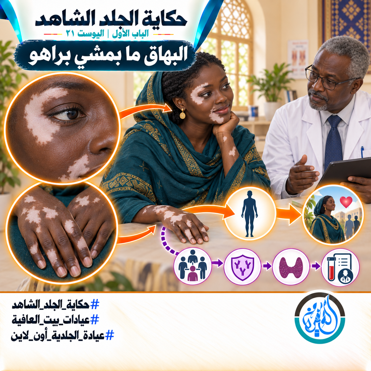 الباب الأول: البهاق ما بمشي براهو