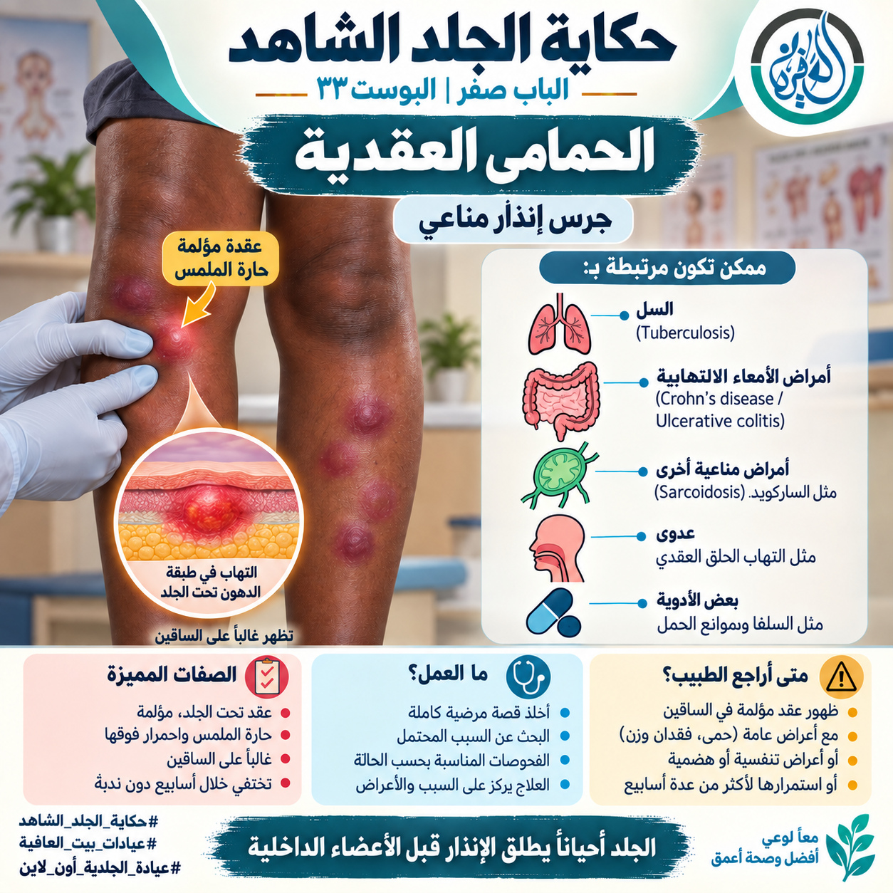 الباب الثاني: العقد الحمرا المؤلمة