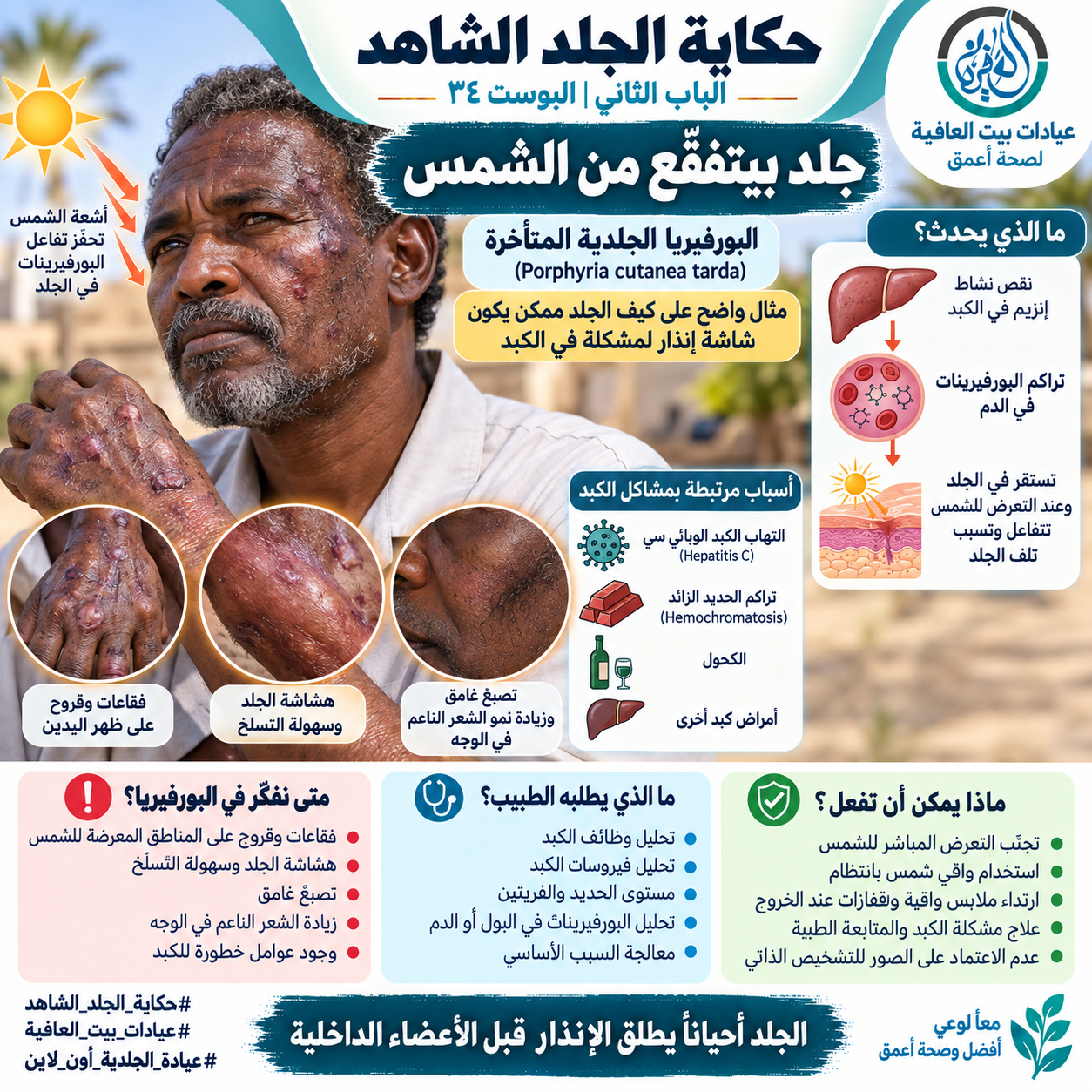 الباب الثاني: جلد بيتفقّع من الشمس