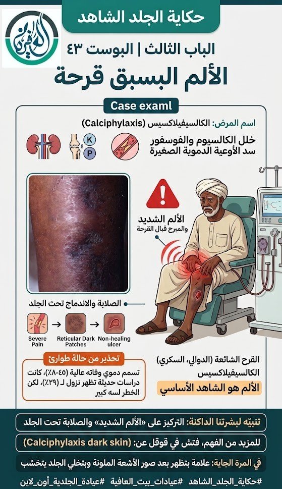 الباب الثالث: الألم البسبق قرحة