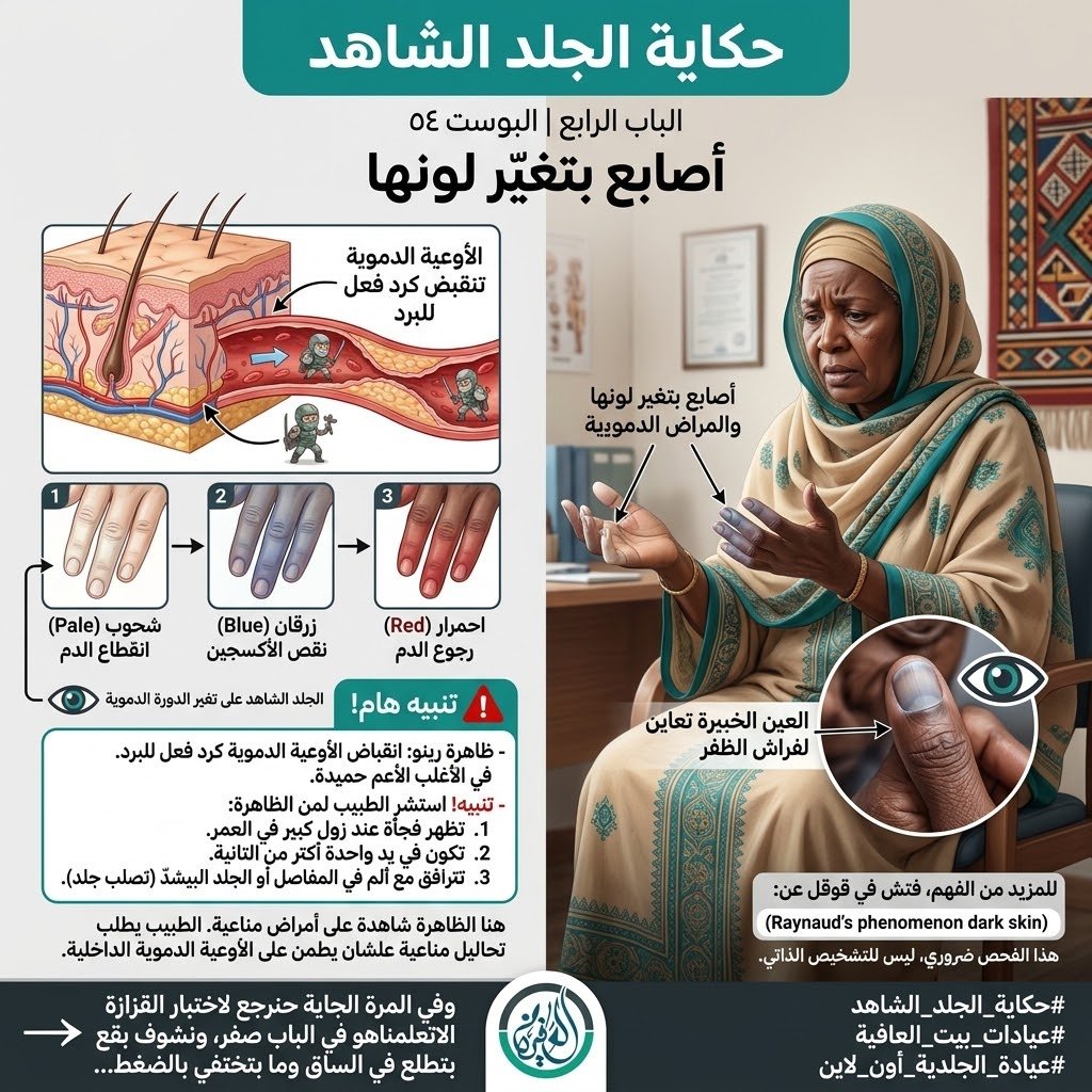 الباب الرابع: أصابع بتغيّر لونها