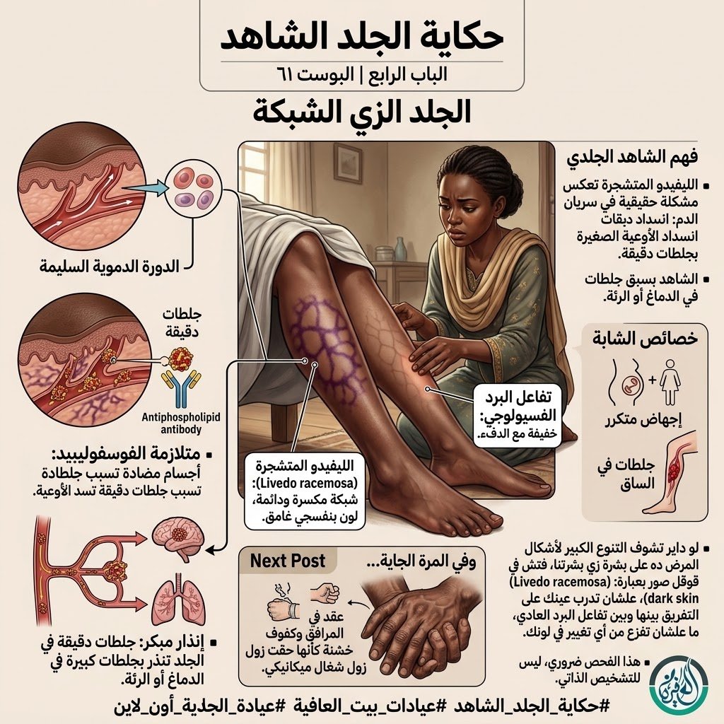 الباب الرابع: الجلد الزي الشبكة