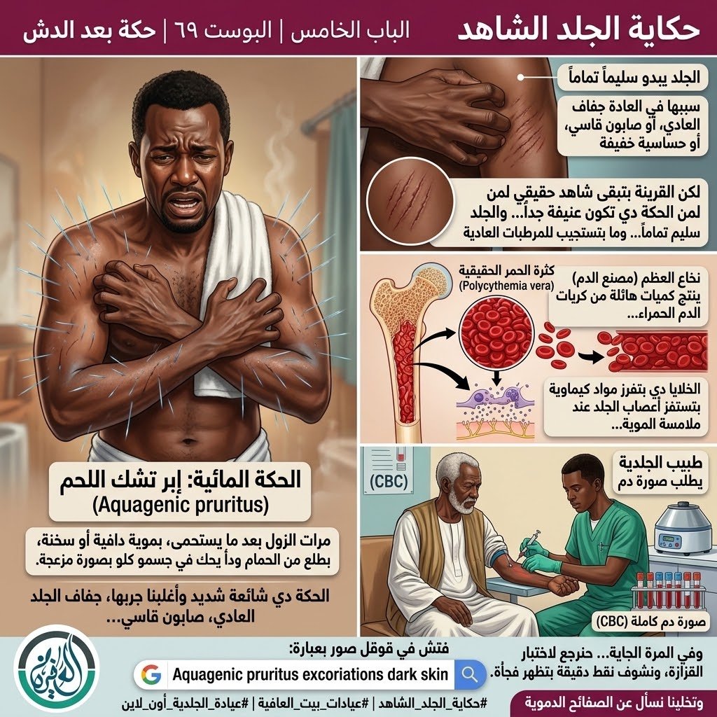 الباب الخامس: حكة بعد الدش