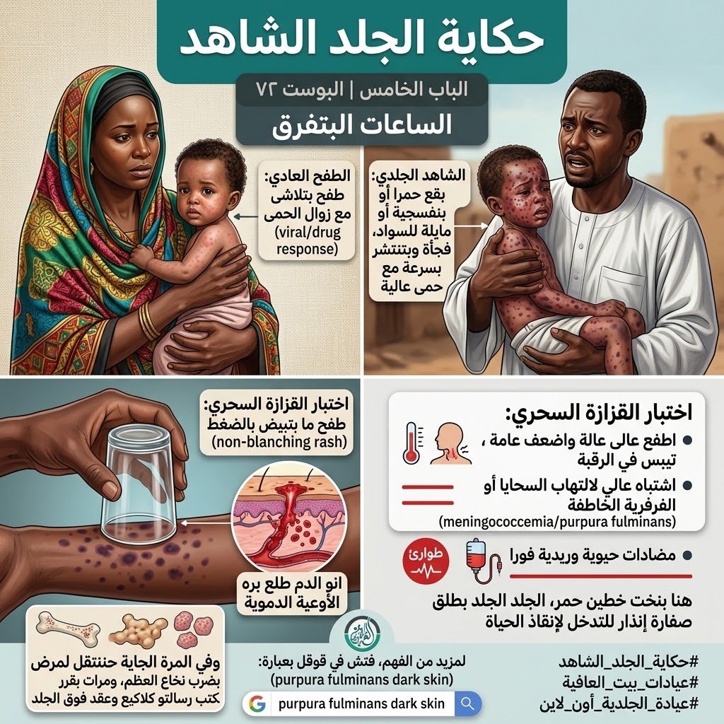 الباب الخامس: الساعات البتفرق
