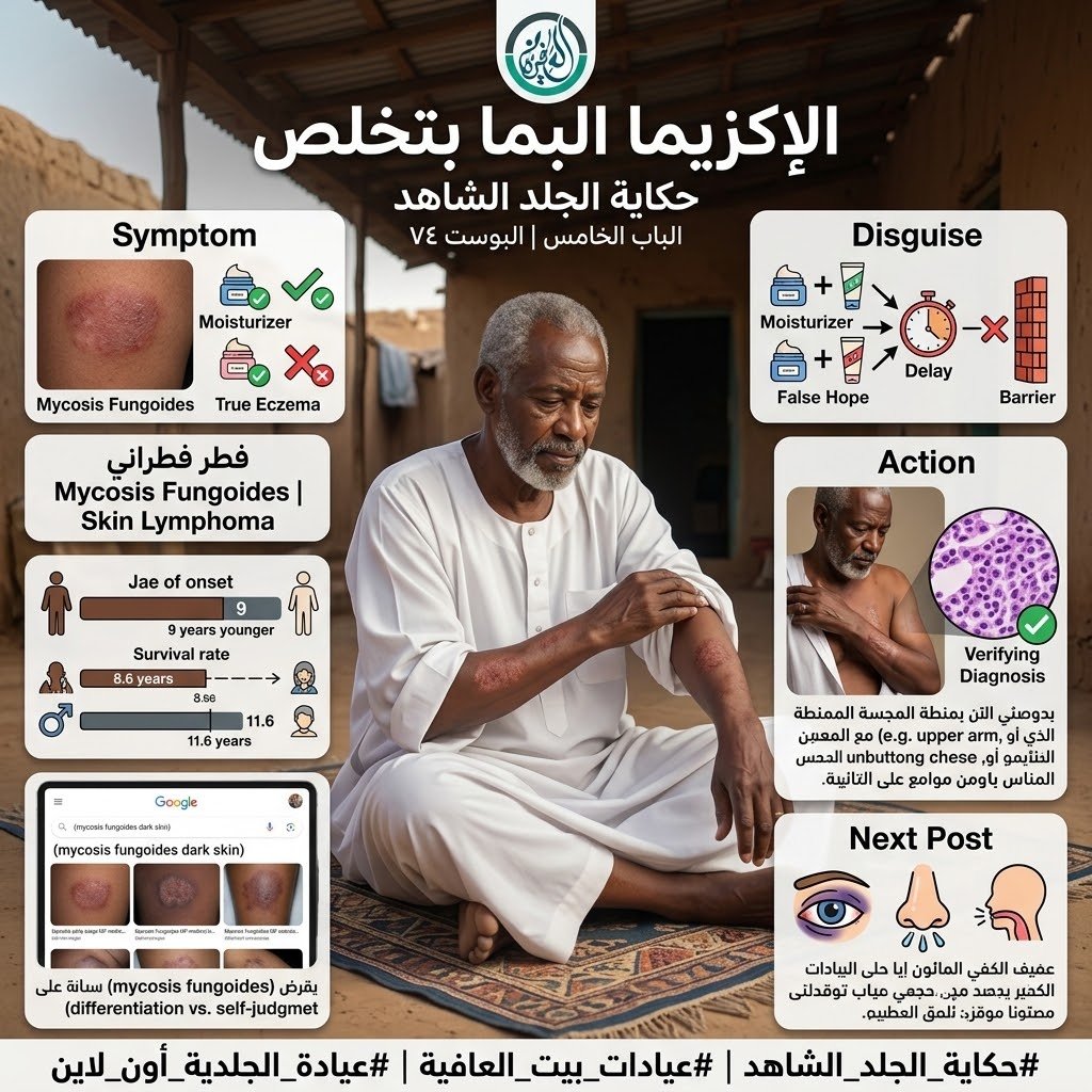 الباب الخامس: الإكزيما البما بتخلص