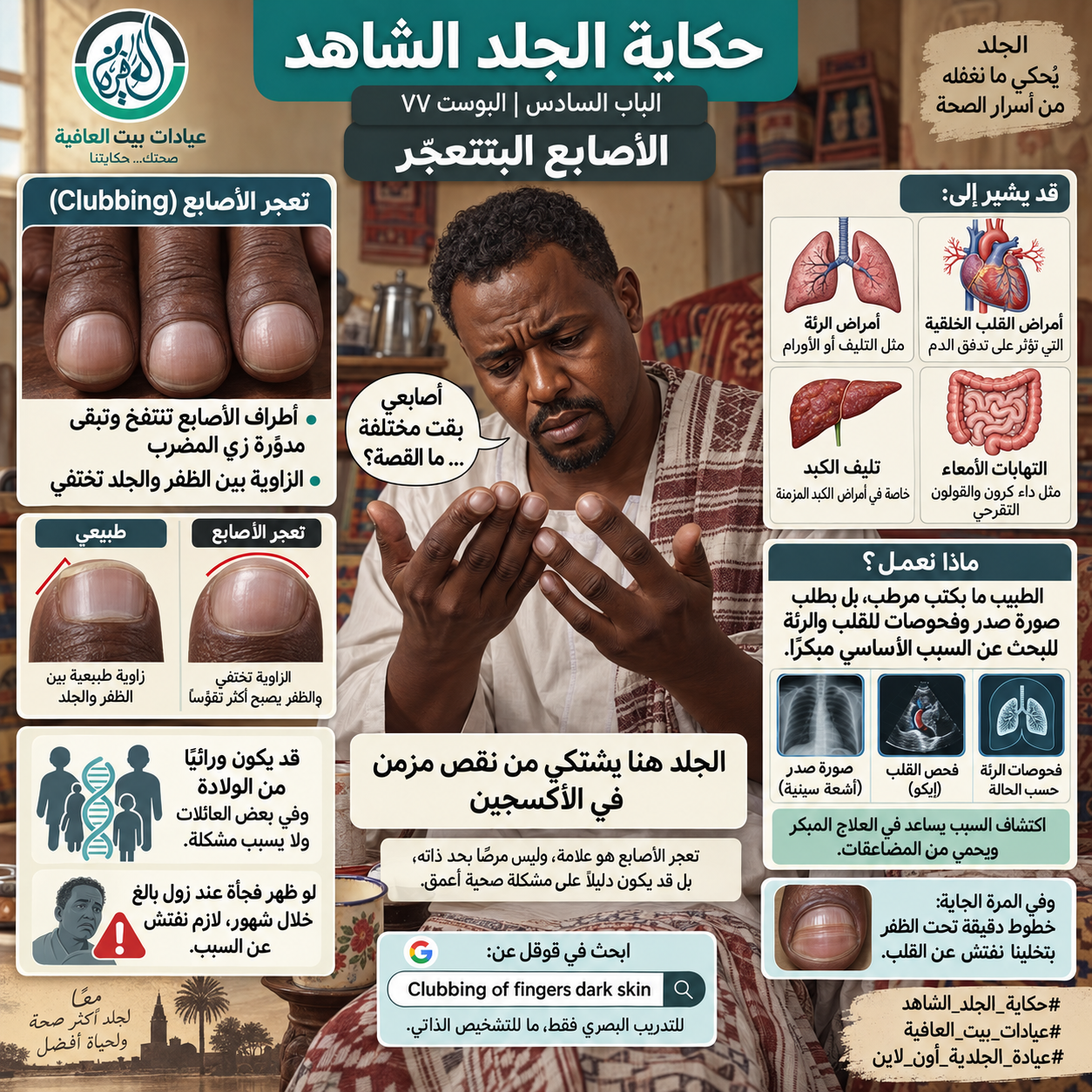 الباب السادس: الأصابع البتتعجّر