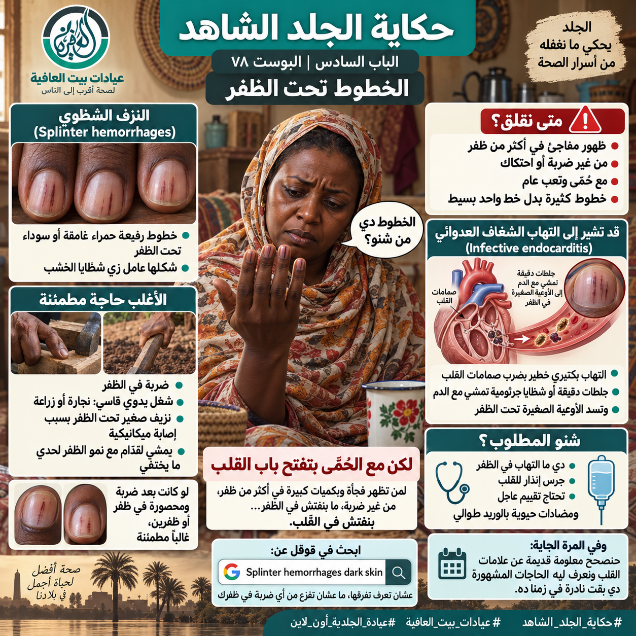 الباب السادس: الخطوط تحت الظفر