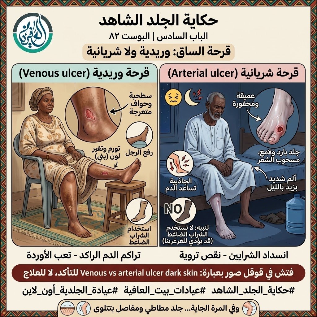 الباب السادس: قرحة الساق: وريدية ولا شريانية